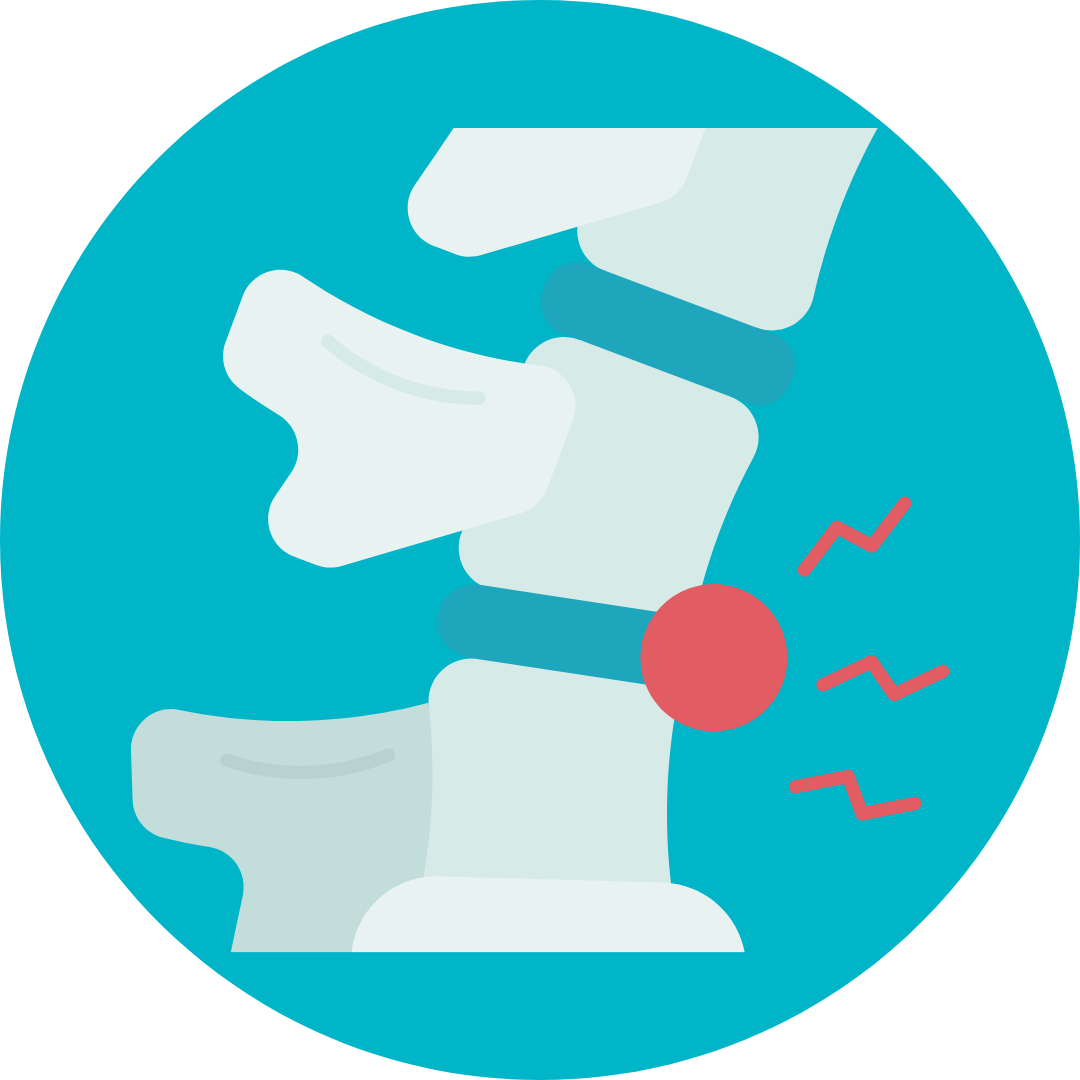 Slipped Disc Treatment in Noida | Dr Naveen Pandita