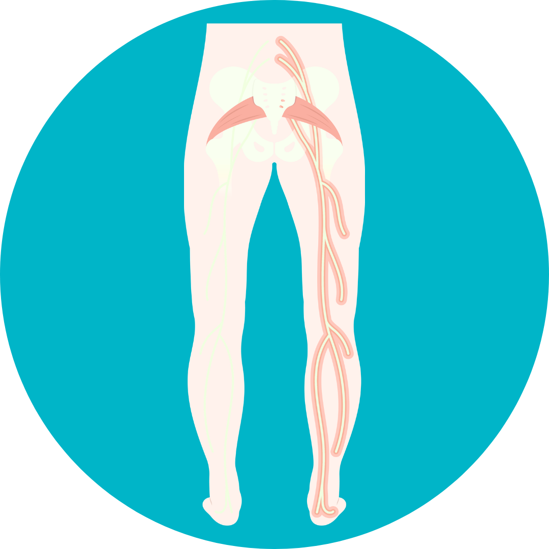 Sciatica Treatment in Noida | Dr Naveen Pandita