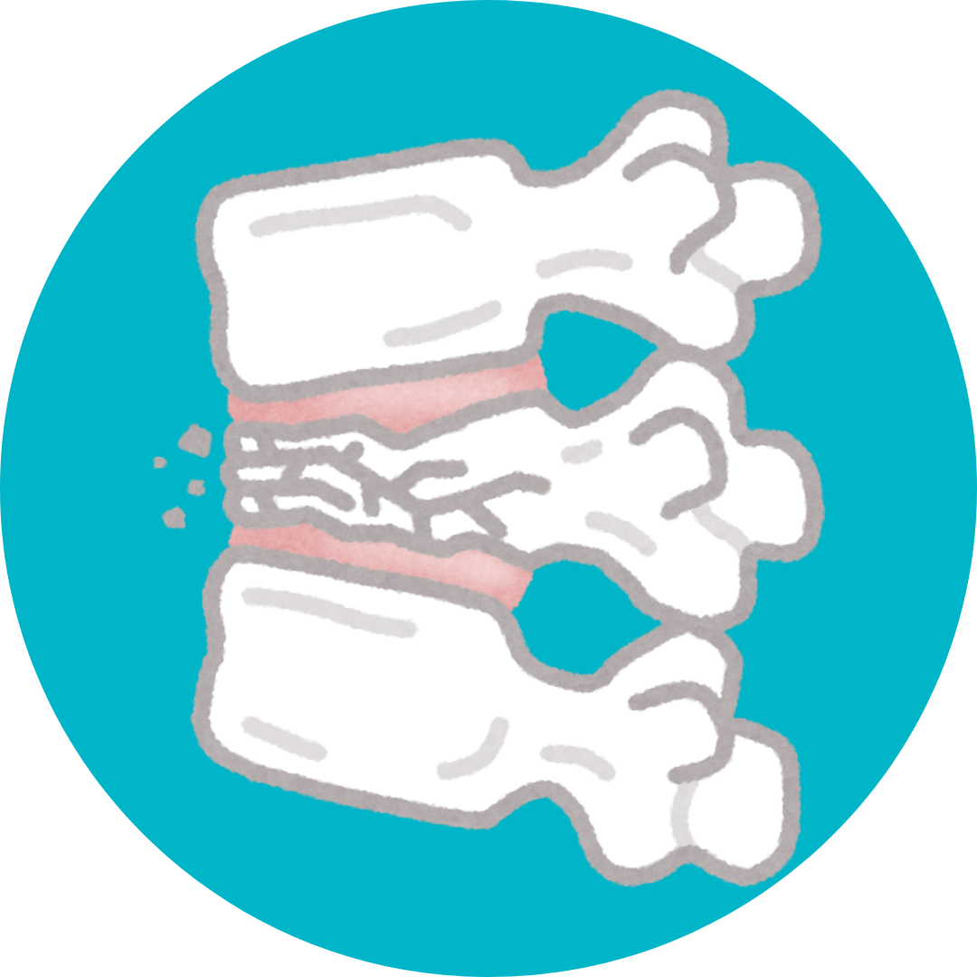 Spinal Stenosis Treatment in Noida | Dr Naveen Pandita