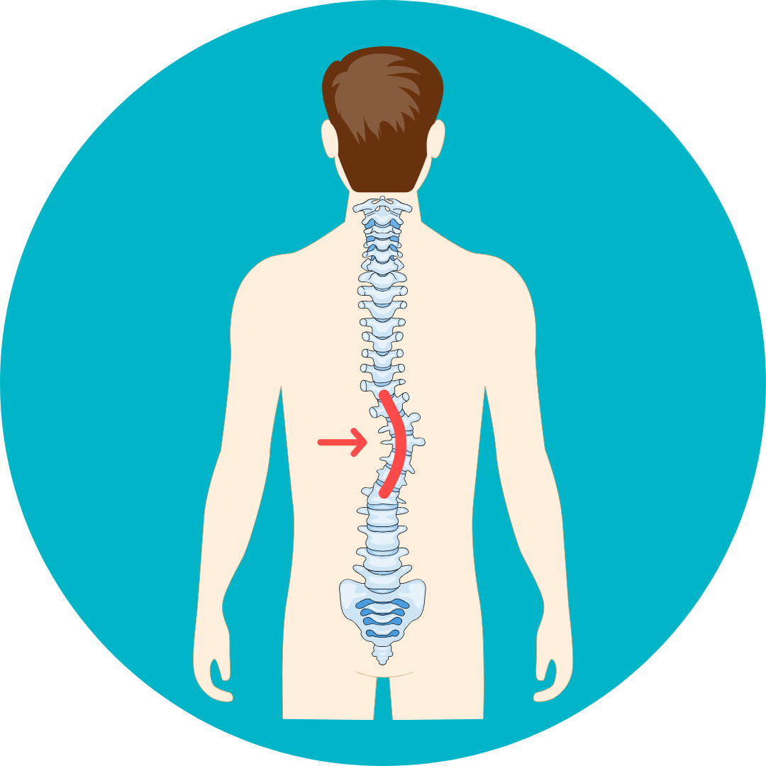 Spine Deformity Treatment in Noida | Dr Naveen Pandita