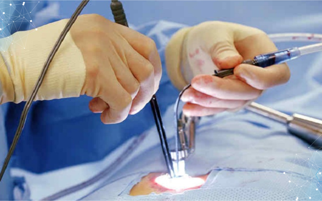 Minimally Invasive Spine Surgery