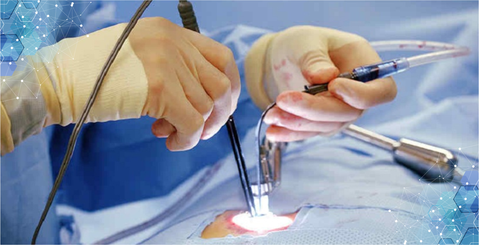 Minimally Invasive Spine Surgery Treatment in Noida | Dr Naveen Pandita