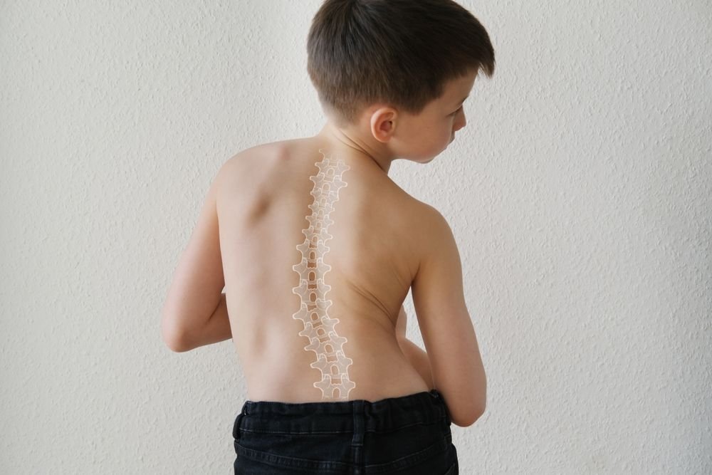 Pediatric Scoliosis Surgery