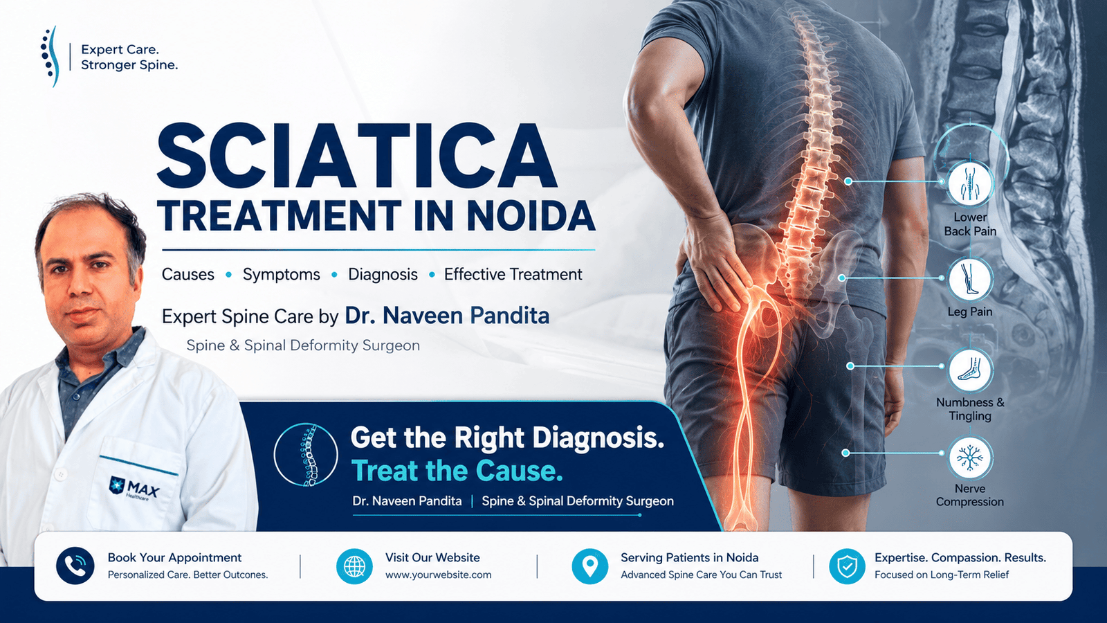 Sciatica Treatment in Noida | Dr Naveen Pandita