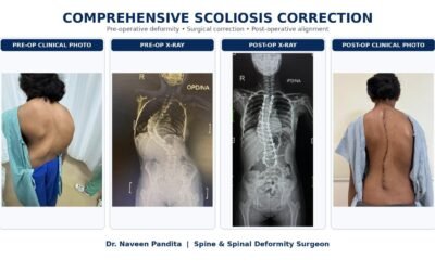 Scoliosis Surgery Case Study