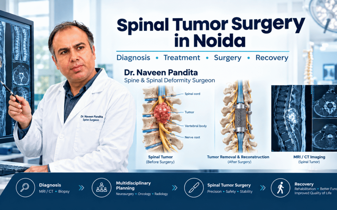 Spinal Tumor