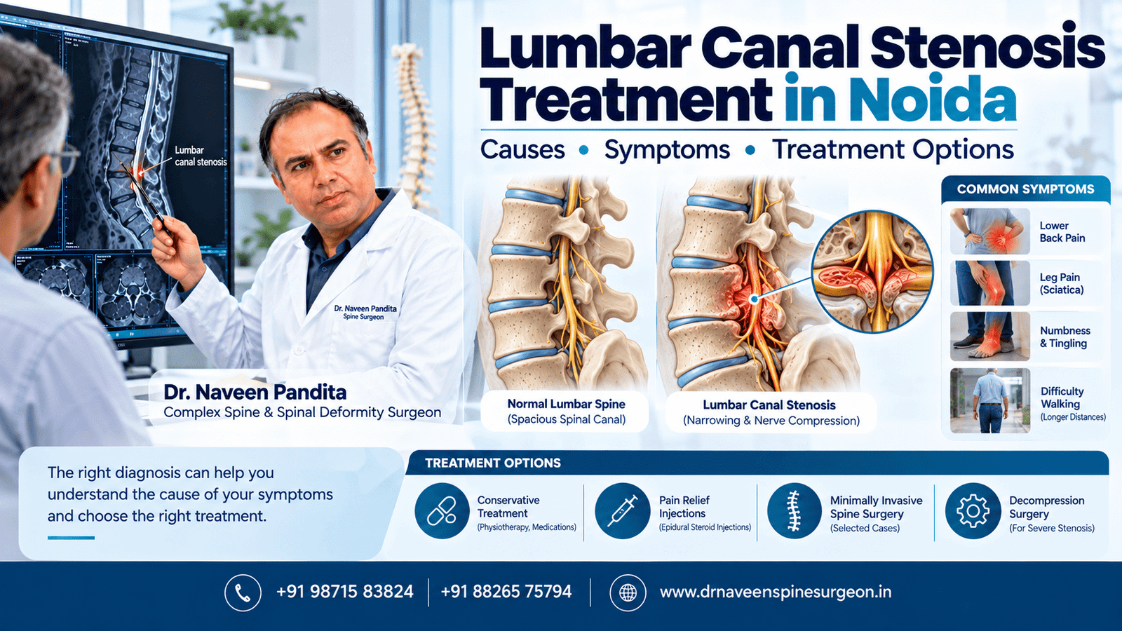 Lumbar Canal Stenosis Treatment in Noida | Dr Naveen Pandita
