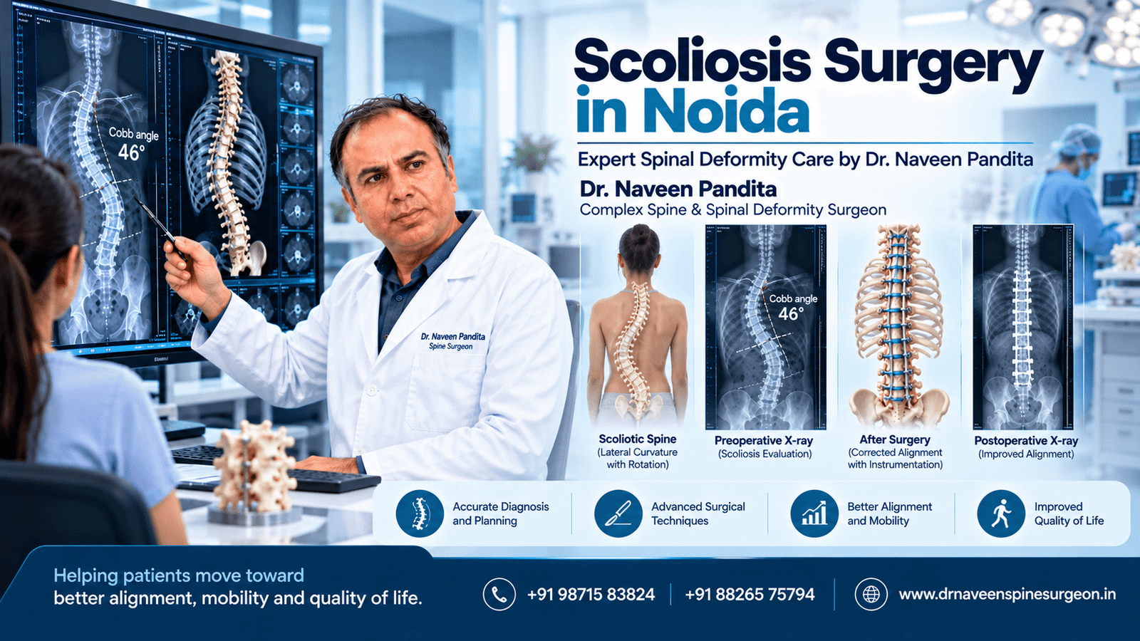 Scoliosis Surgery in Noida | Dr Naveen Pandita