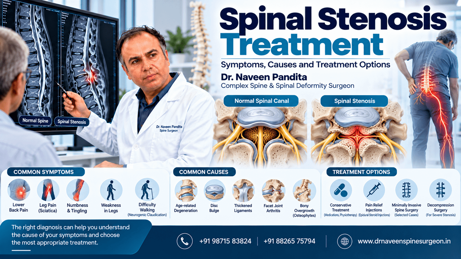 Spinal Stenosis Treatment | Dr Naveen Pandita