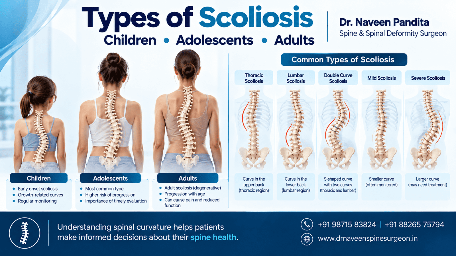 Types of Scoliosis | Dr Naveen Pandita